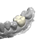 샤인치과기공소 이미지