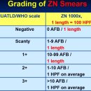 Re:결핵 ( AFB stain grading) 이미지