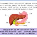 담낭암 담낭암 원인 증상 치료 담낭암 발견이 늦은 이유 쓸개암 담낭암 생존율 이미지