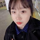 400 | 신사역 피부과 올타이트 400샷 후기, 순자리프팅 라인 변화 리얼 기록