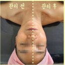 피부맑음 이미지