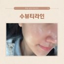 화성 피부관리샵 :: 남양 피부관리 추천 수뷰티라인 피부 케어 후기