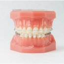 미소고운치과 네이버블로그