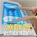 리멤버피부과의원 | 양주 리멤버 피부과 어린이 광선치료 솔직 후 기