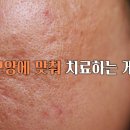 로담