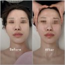 6162 | 대구 신부관리 끝판왕 ✨ '라플러스에스떼 대명점'에서 예비신부 피부관리 받고 온 솔직후기