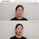 르수플