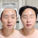 웨이브휘트니스 | 목동피부관리 엘피지오 목동점에서 예랑이 써마웨이브 받은 후기 (feat. 리조트휘트니스 이용권 혜택)