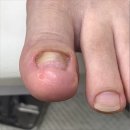 미엘네일 이미지