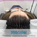 한걸음케어 | 경기광주탈모관리 M자 탈모케어 릿따스타일 클리닉 후기