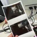 [👼]포항 여성아이병원에서 1박2일 유도분만 후기🐣