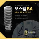 순천탑치과의원 네이버블로그