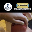 발각질제거부터 블랙테라피 디톡스 관리까지 말끔하게 깔끔하게 #디톡스관리 #각질관리 이미지