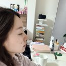 못냄이 | 압구정 루비레이저 내돈내산 후기 / 가격 / 통증 / 딱지 / 화장 / 후 관리