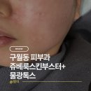 스킨톡스 | 인천 구월동 피부과 쥬베룩 스킨부스터+물광톡스 후기 | 속건조 모공결까지 한 번에 잡고 다운타임 없이...
