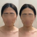오렌지에스테틱 | 광주 윤곽관리 리큐브에스테틱 웨딩관리 후기
