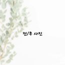 폴크로뷰티 슈가링왁싱