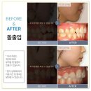 라임치과 네이버블로그