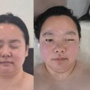 체온테라피평택 | 평택피부관리 전문 티리온 피오렌에스테틱 평택본점에서 힐링한 하루