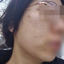 감남 | [뷰티] 소개팅 전 필승 관리/ 옳음뷰티에서 닥토필 받고 온 후기
