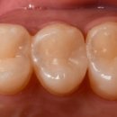 엠웍스 치과기공소 이미지