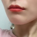 부산하단 바바클리닉에서 입술필러 맞은 후기 :)