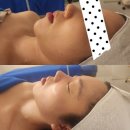 상남부분정비3급 | 상남동피부관리 윤곽관리 받고 작은얼굴되는 창원 예담에스테틱 상남점