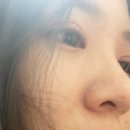 [일기]라고 쓰고 내 쌍수 썰+내가 필요할 때 읽으려고 적는 팁