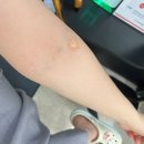 나은병원 신관 3층 | 5. 임신 사전 건강관리 (가임력 검사) 신청, 검사, 그리고 지원금 환급 후기