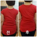 척추관리센터 네이버블로그