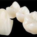 다이아몬드치과기공소 이미지