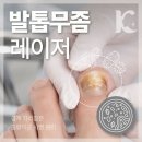 광주발톱무좀 병원 레이저 후 고쳐야하는 생활습관? 수완동피부과 가기 전 체크