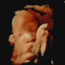 주수기록 : 28w~34w 백일해주사 / 임신후기일상 / 산전마사지