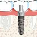 이라인치과의원 이미지
