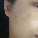 바디플러스샵 | 대구 남구 대명동 | 두피·피부·바디관리 전문샵 1:1 맞춤 케어 ‘라플러스에스떼’ 피부관리 후기