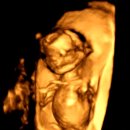 연세포유의원 | [12주~16주]제비의 성별알기 / 이른주수 입체초음파 / 양수검사 그리고 신경관결손검사