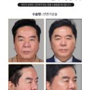 시티성형외과의원 네이버블로그