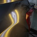 덴트렉스 이미지