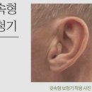 목동독일보청기 이미지