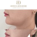 리마인드피부과의원 이미지