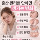 등관리