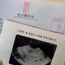 울렁다리농산물 | 임신초기(1-3개월, 0-12주) 후기 아기집 난황 젤리곰 1차기형아 검사