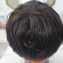 대구증모술 내머리같이
