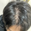 채움 | 대연동두피관리 채움&amp;그리다 후기 및 주차