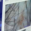 대일빌딩 | 대전 두피클리닉 웰킨 둔산점에서 받은 두피스케일링 관리 후기