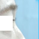 비엔에프의원 이미지