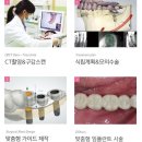 캐드캠치과기공소 이미지