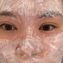 웨촬 앞두고 급하게 받은 기미잡티 관리/인천 루비레이저 1회차 후기