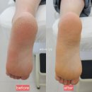 장기역 | 김포 장기동발각질 문제성발관리 받으러 레푸스 김포장기역점 다녀온 후기
