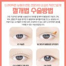 앨리스의원 이미지